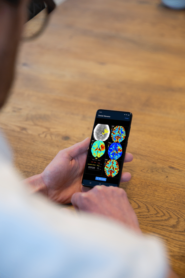 Nicolab StrokeViewer AI platform assisting clinicians in diagnosing acute stroke in Singapore hospitals